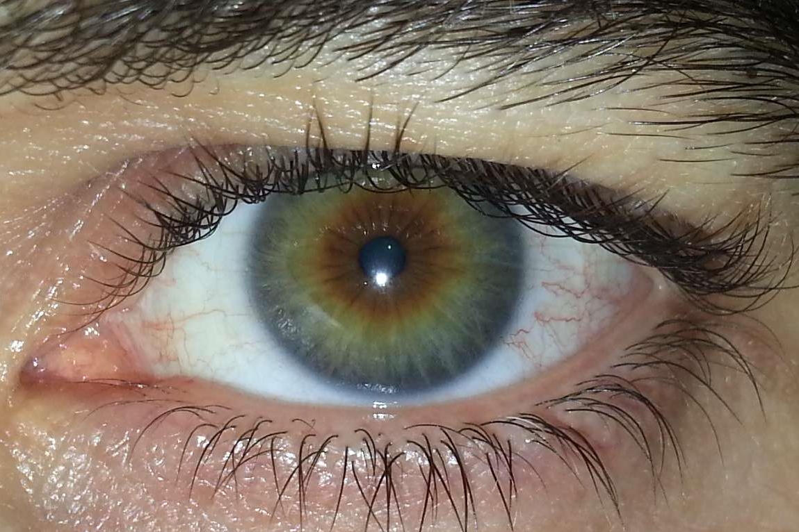 Imagem de Íris artificial se regula sozinha com a luz e poderá ser usada em implantes no tecmundo